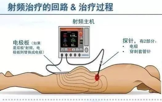 67edfad7ab76b.png 图片4.png