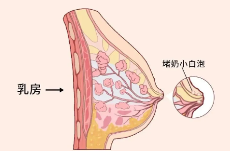 684b9a77999a7.png image.png