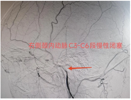 6852aa1e7b25a.png image.png
